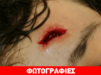 Καταγγέλλουν αστυνομική βία σε βάρος διαδηλωτών στην Πάτρα