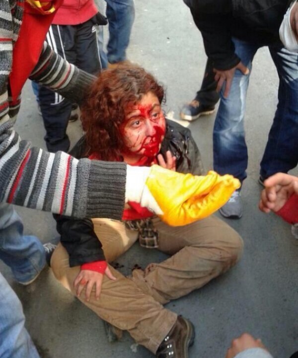 Διαδηλώτρια χτυπημένη στο πρόσωπο. Τα περισσότερα επεισόδια σημειώθηκαν στην Μπεσίκτας