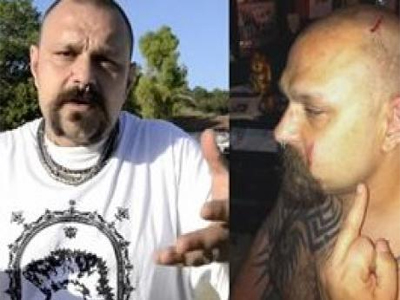 Ακροδεξιοί γρονθοκόπησαν Ιταλό τραγουδιστή