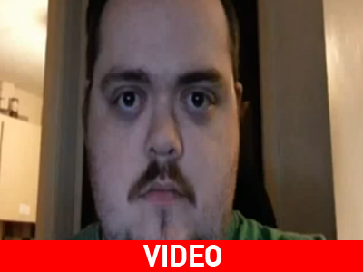 Έχει την ικανότητα να “βγάζει” τα μάτια του