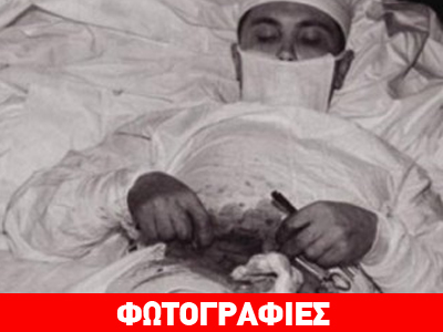 Χειρούργησε τον εαυτό του Χειρούργησε τον εαυτό του