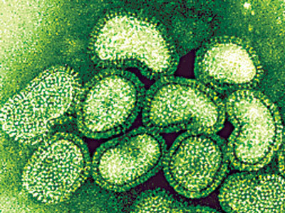 Το δεύτερο κύμα της πανδημίας θα είναι πολύ πιο σφοδρό!