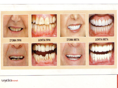 «Γιατρέ, γιατί σφίγγω τα δόντια μου;»