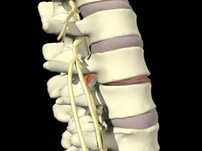 Με ελαφρώς πιο αδύναμα κόκαλα πορεύονται οι χορτοφάγοι