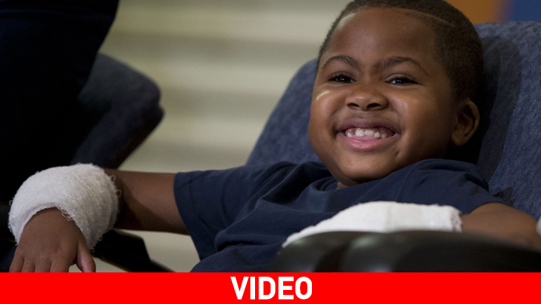 ΗΠΑ: Επιτυχής μεταμόσχευση άνω άκρων σε 8χρονο αγόρι