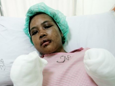 Της έσπασε τα πλευρά και την έκαψε με σίδερο! Της έσπασε τα πλευρά και την έκαψε με σίδερο!