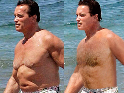 Ναι, και οι διάσημοι έχουν ατέλειες