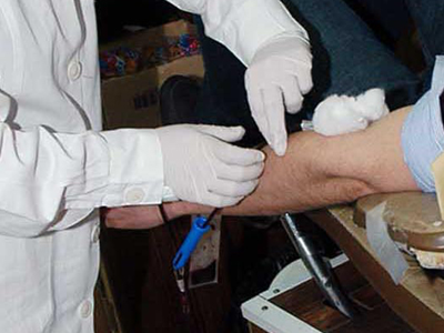 Προσοχή στις αιμοληψίες λόγω του «ιού του Δυτικού Νείλου»