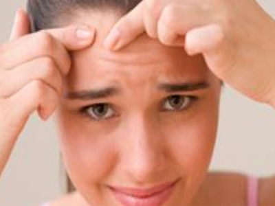 Παχυσαρκία και ακμή