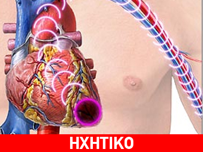 Νέες ελπίδες μετά το έμφραγμα