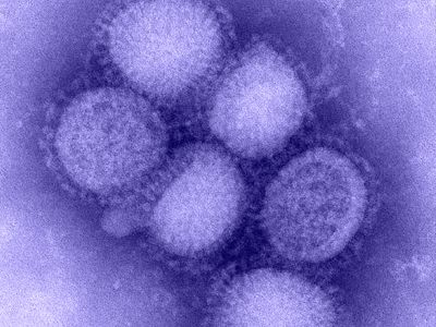 Σε κίνδυνο βρέφος λόγω νέας γρίπης