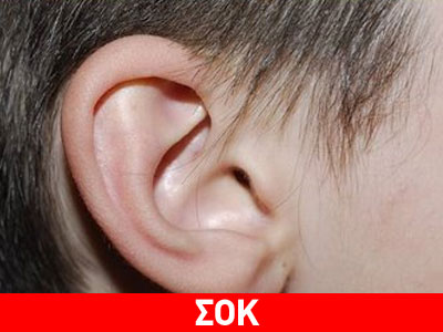 Του έκοψε το αυτί γιατί δεν του παραχώρησε προτεραιότητα!
