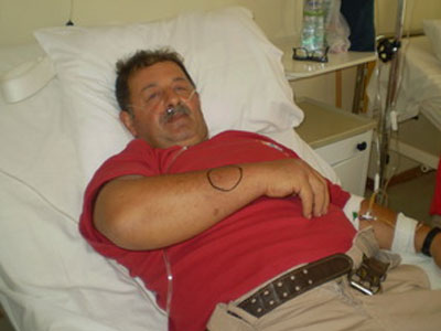 Οχιά δάγκωσε πυροσβέστη