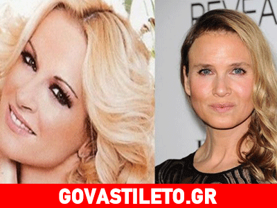 Η Μπεκατώρου σύμμαχος της Ζελβέγκερ: Συνέχεια κάνω μπότοξ και ενέσιμα!