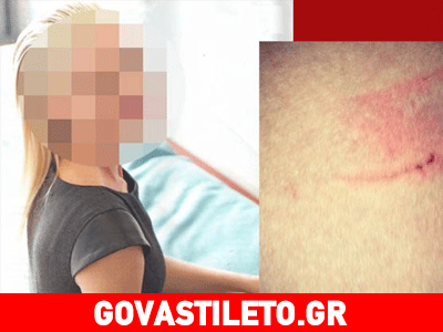 Ποια είναι η celebrity που τραυματίστηκε στις πρόβες του «DWTS 5» ;