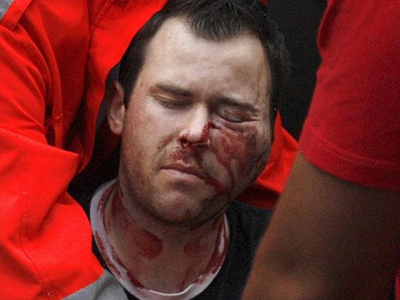 Πέθανε ο φίλαθλος της Toulouse