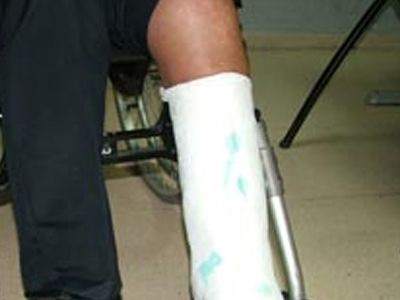 Στραβοπατήματα