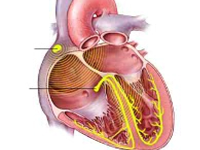 Γονίδιο-κίνδυνος για καρδιακή ανεπάρκεια