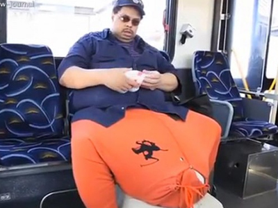 Ζητά βοήθεια για θεραπεία από την ελεφαντίαση