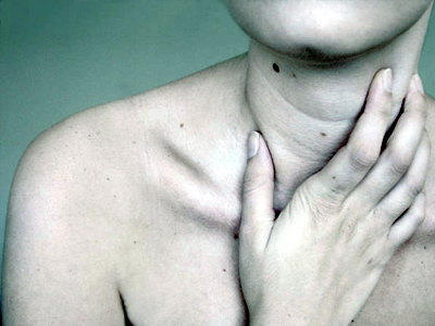 Αντιμετωπίστε το αλεργικό σοκ