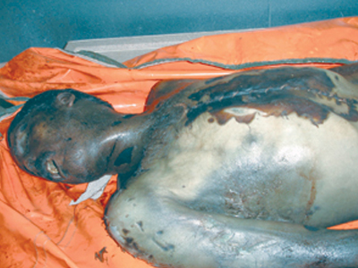 Με χημικά όπλα οι Τούρκοι κατά του ΡΚΚ