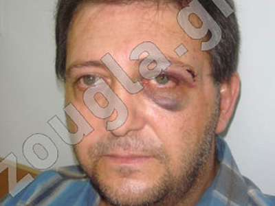 Μήνυση του αστυνομικού με την… περούκα κατά συναδέλφων του