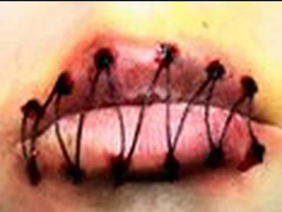 Απεργία πείνας στα κρατητήρια Αλικαρνασσού