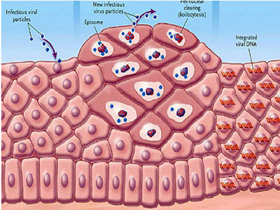 SEXUALITY: Νέα για τον HPV-Μέρος 1ο