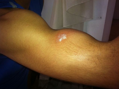 Ποιος χτύπησε στις πρόβες του «Dancing»;