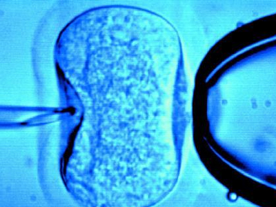 Σαρώνει η υπογονιμότητα στα νέα ζευγάρια