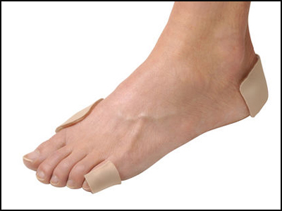 Κάλοι… ένα σοβαρό πρόβλημα