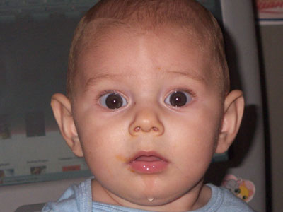 Αφεστώτα ώτα (Πεταχτά αυτιά)