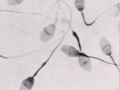 Έβγαλε κρυφά το… σπέρμα του από την φυλακή