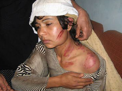 Έρευνα για τη δολοφονία αμάχων από Αυστραλούς στρατιώτες στο Αφγανιστάν