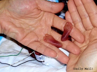 Μωρό πέντε μηνών!