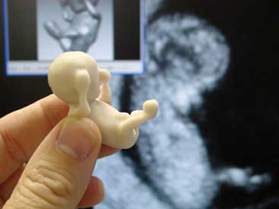 Κρατήστε στα χέρια το… αγέννητο μωρό σας