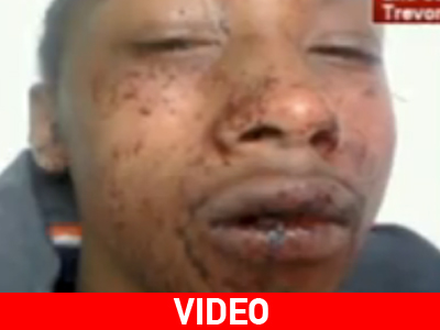 Άγριος ξυλοδαρμός 14χρονου από αστυνομικούς