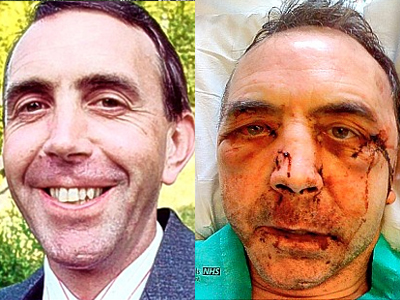 Ξυλοκόπησε άγρια τον καθηγητή του μετά από 14 χρόνια