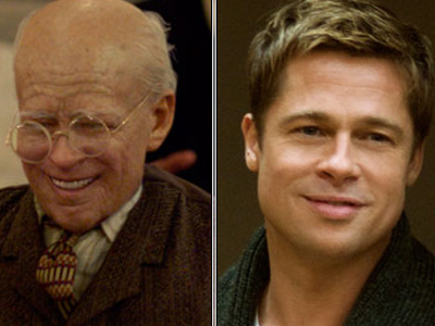 Το σύνδρομο ”Μπέντζαμιν Μπάτον”