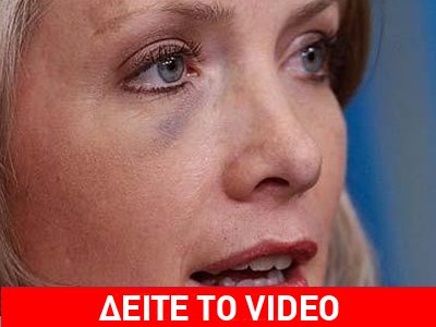 Μαύρισαν το μάτι της εκπροσώπου του Λευκού Οίκου