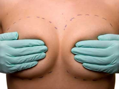 Τι πρέπει να γνωρίζετε για την αυξητική στήθους