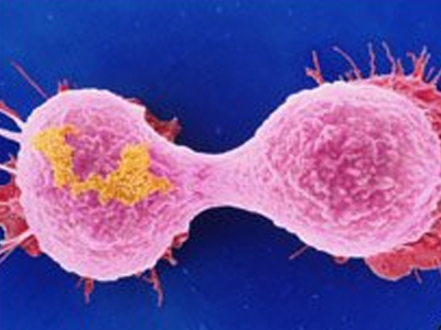 Νέο φάρμακο –  ελπίδα στη μάχη του καρκίνου