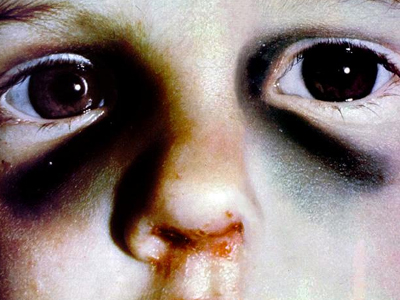 Επτά χρόνια φυλακή για κακοποίηση ανηλίκου μέχρι θανάτου