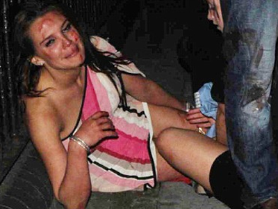 Φωτογραφίες σοκ από επίθεση σε μοντέλο