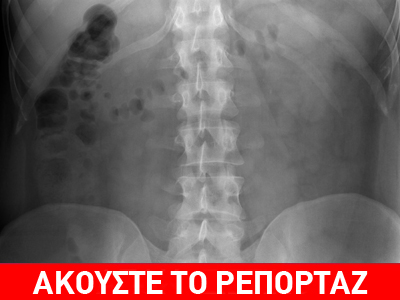 «Έβαλα αγγελία να πουλήσω το νεφρό μου»