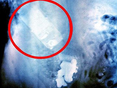 Σκύλος κατάπιε κινητό