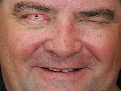 Βλέπει από… το δόντι του