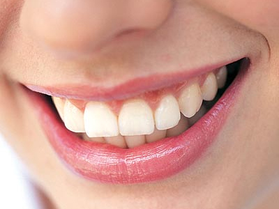 Με κάθε εγκυμοσύνη, χάνετε δόντια