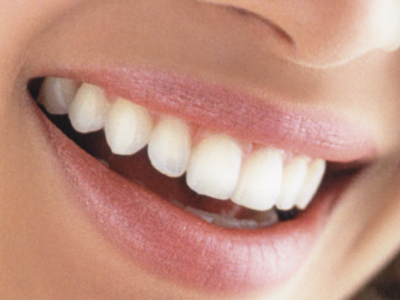 Oι 5 μύθοι γύρω από τη φροντίδα των δοντιών