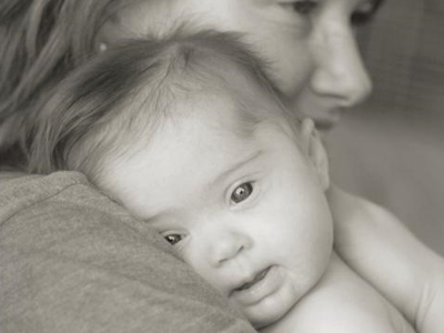 Το παιδάκι με τα σχιστά μάτια… Σύνδρομο Down